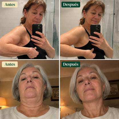 Osmotia® – Drenante linfático